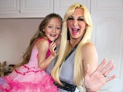 REGALA OPERACIÓN DE PECHOS A SU HIJA DE SIETE AÑOS