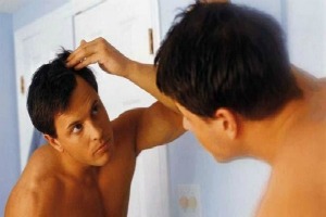 TIPS B�SICOS PARA PREVENIR LA CALVICIE