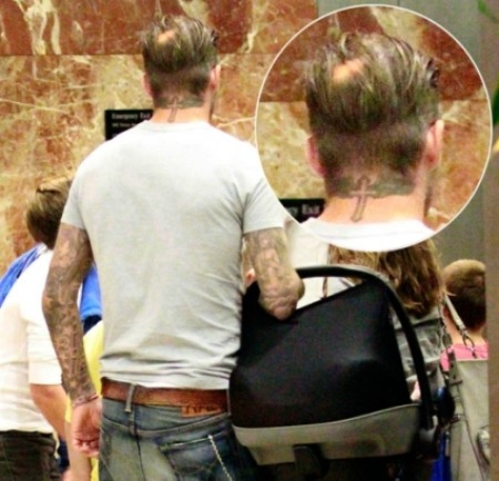ES REAL LA CALVICIE DE DAVID BECKHAM