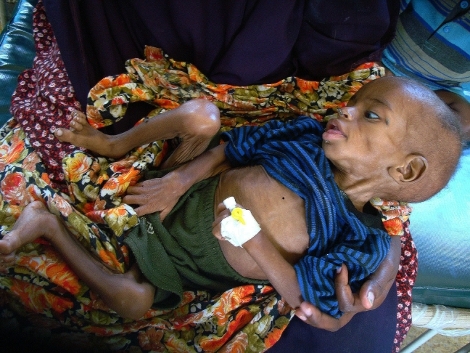 MESES PR�XIMOS SON CRUCIALES PARA VENCER LA HAMBRUNA EN SOMALIA