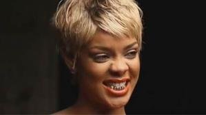 RIHANNA SE IMPLANTA DENTADURA DE ORO