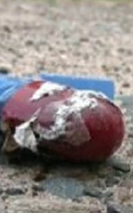 QUITAN UNA BOMBA DEL PECHO DE UN HOMBRE