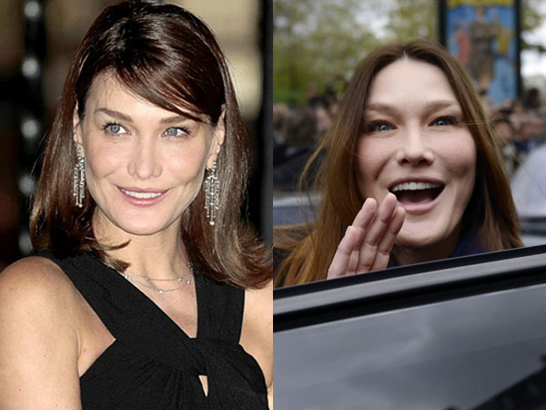 FOTOS DE CARLA BRUNI ANTES Y DESPU�S DEL B�TOX