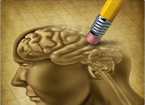 AS� BORRA LOS RECUERDOS EL CEREBRO