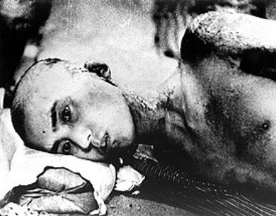 LAS FOTOS M�S DESGARRADORAS JAM�S VISTAS DE HIROSHIMA