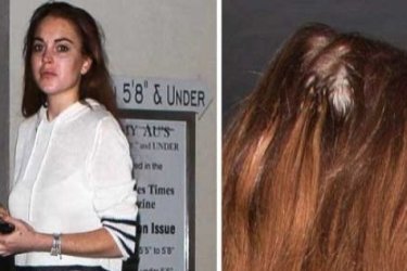 FOTOS: LINDSAY LOHAN PIERDE EL CABELLO - LINDSAY LOHAN CALVA