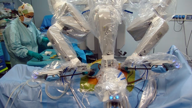 PRIMER TRASPLANTE DE H�GADO HECHO POR UN ROBOT