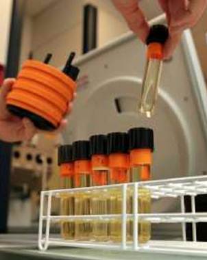CREAN UN TEST QUE DETECTA LA OSTEOPOROSIS