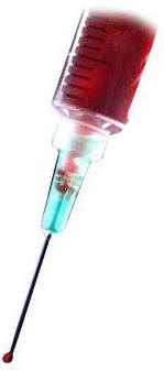 TEST DE SANGRE AYUDAR�A A DETECTAR C�NCER DE MAMA