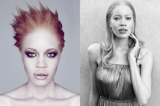 Fotos: Conoce a la primera modelo afroamericana albina