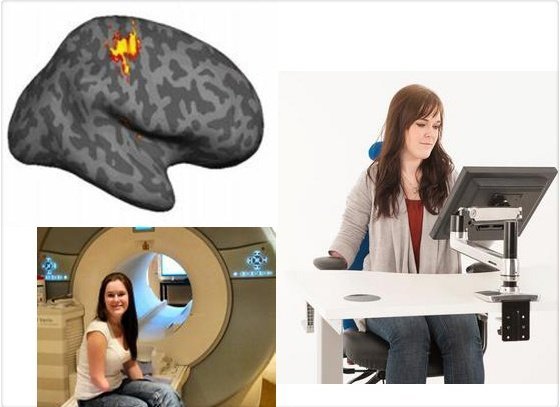 ¿Qué piensa el cerebro de las amputaciones?